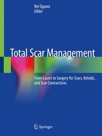 bokomslag Total Scar Management