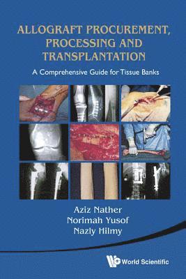 Allograft Procurement, Processing And Transplantation: A Comprehensive Guide For Tissue Banks 1