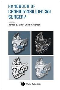 bokomslag Handbook Of Craniomaxillofacial Surgery