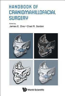 Handbook Of Craniomaxillofacial Surgery 1