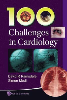 100 Challenges In Cardiology 1