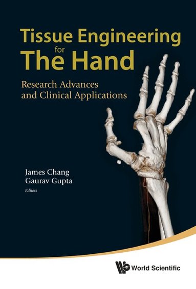 Chang James, James Chang, Gaurav Gupta - TISSUE ENGINEERING FOR THE HAND: RESEARCH ADVANCES AND CLINICAL APPLICATIONS, Inbunden