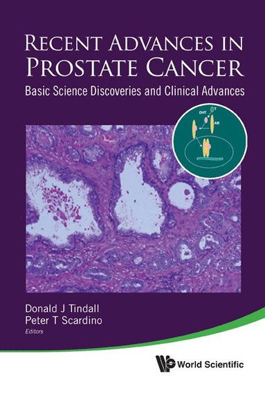 Tindall Donald J, Donald J Tindall, Peter T Scardino - RECENT ADVANCES IN PROSTATE CANCER: BASIC SCIENCE DISCOVERIES AND CLINICAL ADVANCES, Inbunden