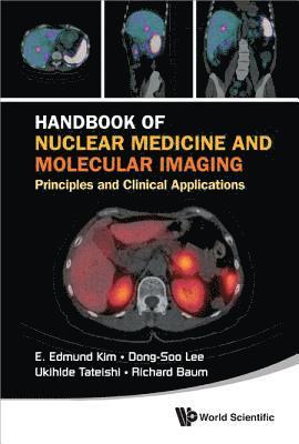 Handbook Of Nuclear Medicine And Molecular Imaging: Principles And Clinical Applications 1
