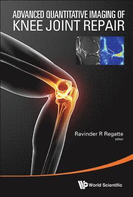 REGATTE RAVINDER R, Regatte Ravinder R, Ravinder R Regatte, Usa) Regatte, Ravinder R (Nyu Langone Medical Centre, Ravinder R. Regatte - Advanced Quantitative Imaging Of Knee Joint Repair, Inbunden