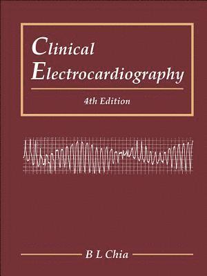 Clinical Electrocardiography (Fourth Edition) 1