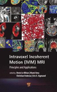 bokomslag Intravoxel Incoherent Motion (IVIM) MRI