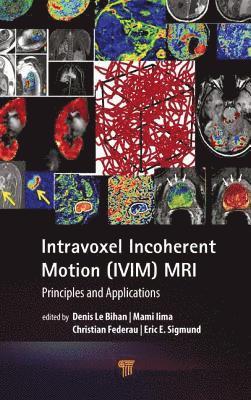 Intravoxel Incoherent Motion (IVIM) MRI 1