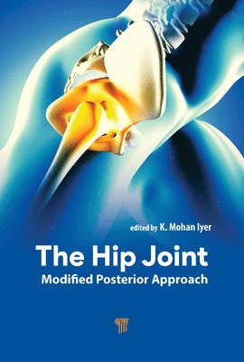 K. Mohan Iyer - Hip Joint, Inbunden