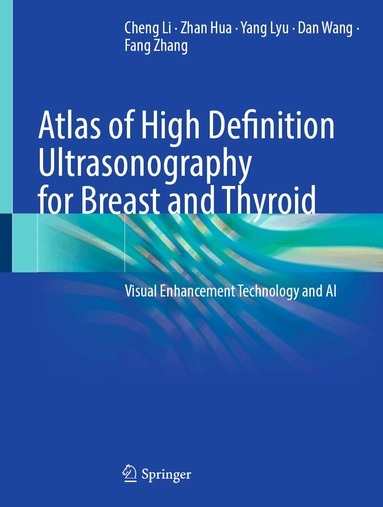 Cheng Li, Zhan Hua, Yang Lyu, Dan Wang, Fang Zhang - Atlas of High Definition Ultrasonography for Breast and Thyroid, Inbunden
