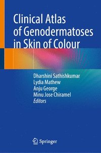 bokomslag Clinical Atlas of Genodermatoses in Skin of Colour