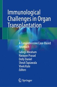 bokomslag Immunological Challenges in Organ Transplantation
