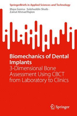 bokomslag Biomechanics of Dental Implants