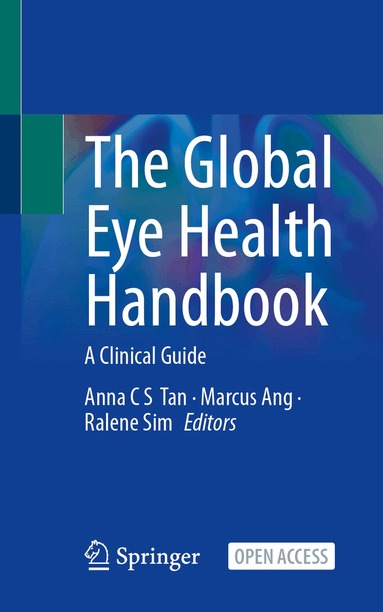 Anna C S Tan, Marcus Ang, Ralene Sim - Global Eye Health Handbook, Häftad