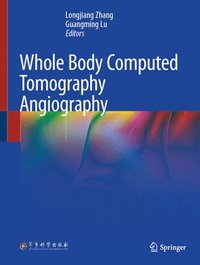 bokomslag Whole Body Computed Tomography Angiography