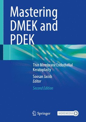 Mastering DMEK and PDEK 1