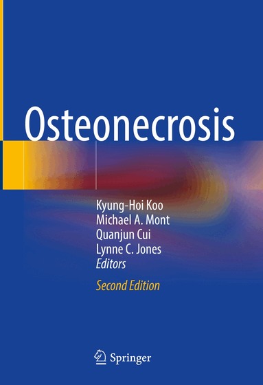 Kyung-Hoi Koo, Michael A. Mont, Quanjun Cui, Lynne C. Jones - Osteonecrosis, Inbunden