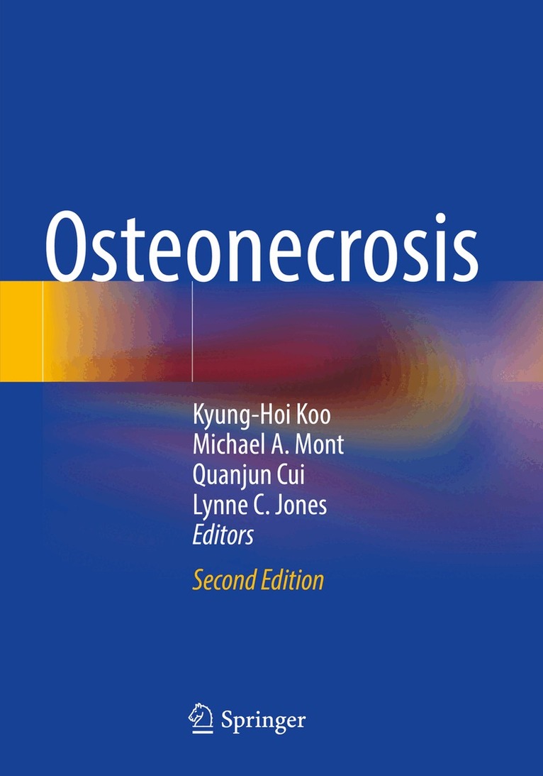 Kyung-Hoi Koo, Michael A. Mont, Quanjun Cui, Lynne C. Jones - Osteonecrosis, Häftad. Tillgänglighet: Lägg i varukorg