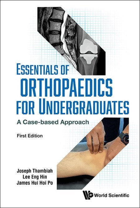 Joseph Thambiah, Eng Hin Lee, James Hoi Po Hui - ESSENTIALS OF ORTHOPAEDICS FOR UNDERGRADUATES: A CASE-BASED APPROACH, Häftad. Tillgänglighet: Tillfälligt slut