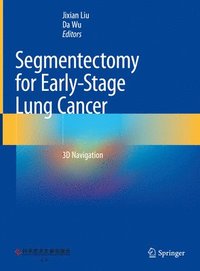 bokomslag Segmentectomy for Early-Stage Lung Cancer