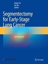 bokomslag Segmentectomy for Early-Stage Lung Cancer