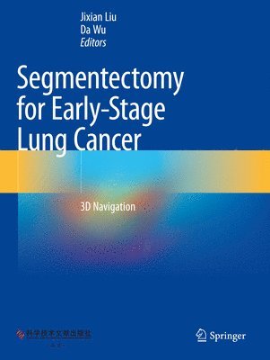 Segmentectomy for Early-Stage Lung Cancer 1