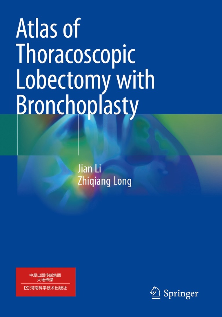 Jian Li, Zhiqiang Long - Atlas of Thoracoscopic Lobectomy with Bronchoplasty, Häftad