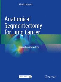 bokomslag Anatomical Segmentectomy for Lung Cancer