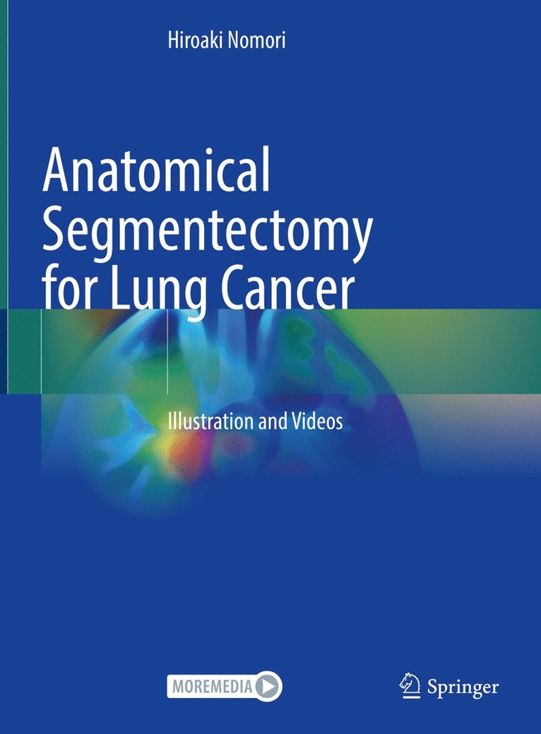 Anatomical Segmentectomy for Lung Cancer 1