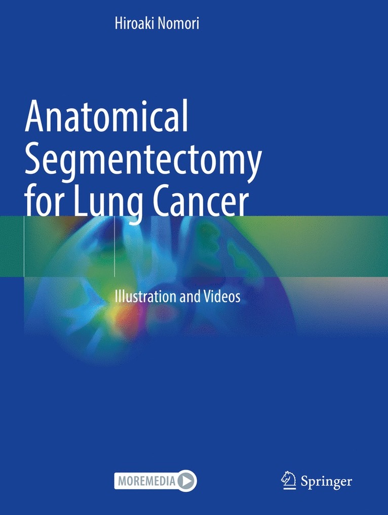 Anatomical Segmentectomy for Lung Cancer