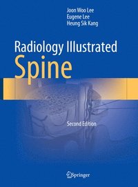 bokomslag Radiology Illustrated: Spine