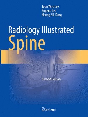 bokomslag Radiology Illustrated: Spine