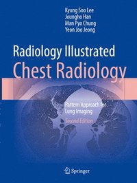 bokomslag Radiology Illustrated: Chest Radiology