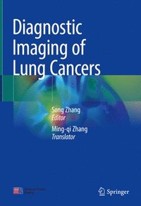 bokomslag Diagnostic Imaging of Lung Cancers