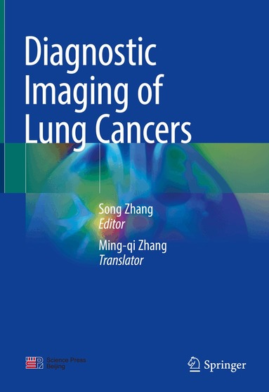 Song Zhang - Diagnostic Imaging of Lung Cancers, Inbunden