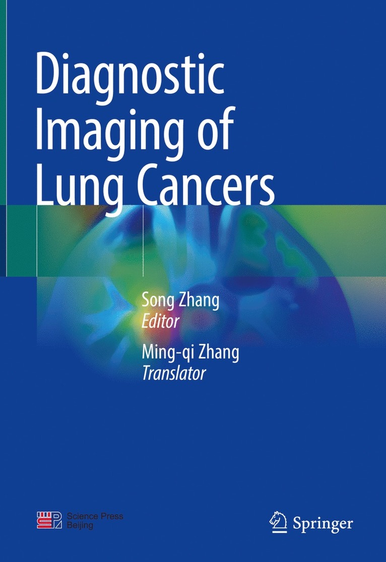 Song Zhang - Diagnostic Imaging of Lung Cancers, Inbunden