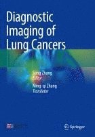 bokomslag Diagnostic Imaging of Lung Cancers