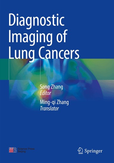Song Zhang - Diagnostic Imaging of Lung Cancers, Häftad