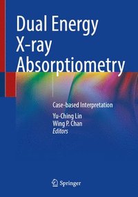bokomslag Dual Energy X-ray Absorptiometry