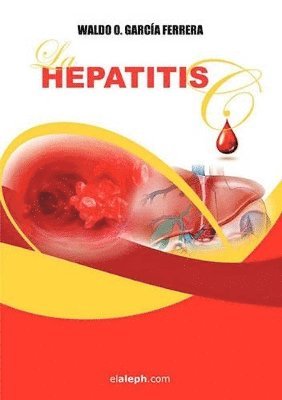 bokomslag Hepatitis C