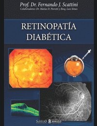 bokomslag Retinopatia diabetica