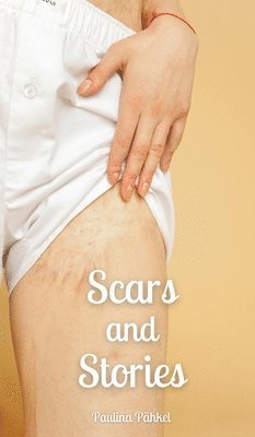 bokomslag Scars and Stories