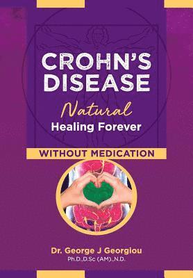 Crohn's Disease
