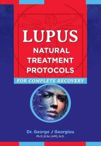 bokomslag Lupus