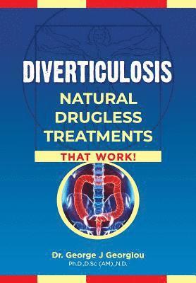 Diverticulosis 1