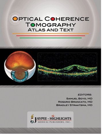 Samuel Boyd, Rosario Brancato, Bradley Straatsma - Optical Coherence Tomography, Inbunden