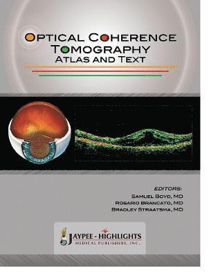 bokomslag Optical Coherence Tomography