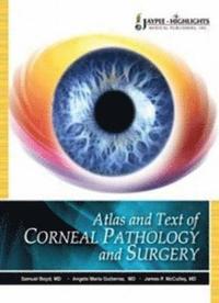 bokomslag Atlas and Text of Corneal Pathology and Surgery