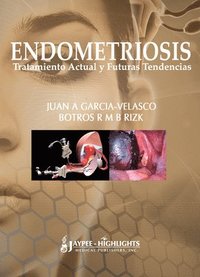 bokomslag Endometriosis: Tratamiento Actual y Futuras Tendencias