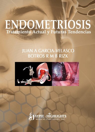 Juan A Garcia-Velasco, Botros RMB Rizk - Endometriosis: Tratamiento Actual y Futuras Tendencias, Inbunden